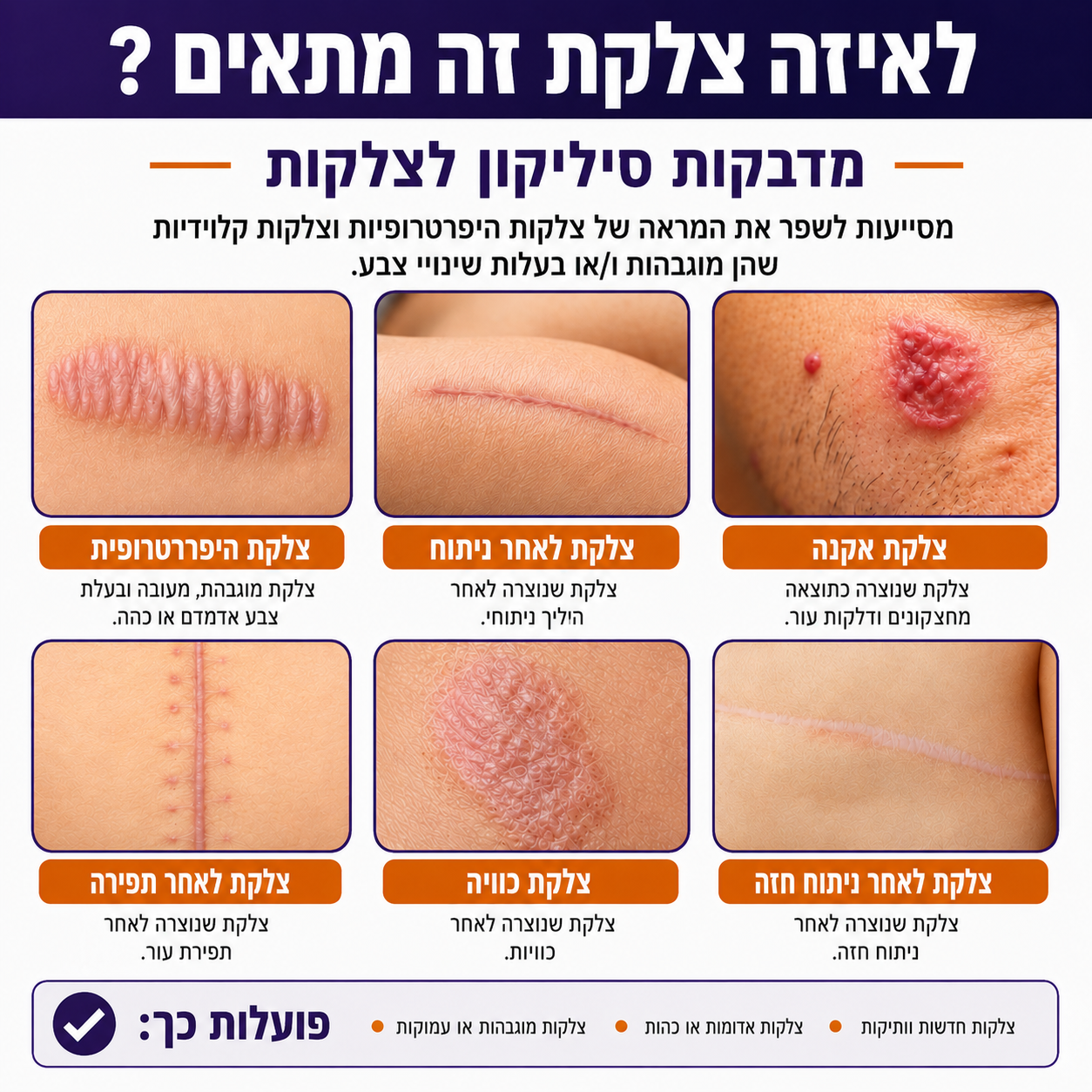 פלסטר צלקות – סיליקון רפואי פרמיום | גליל 3 מטר